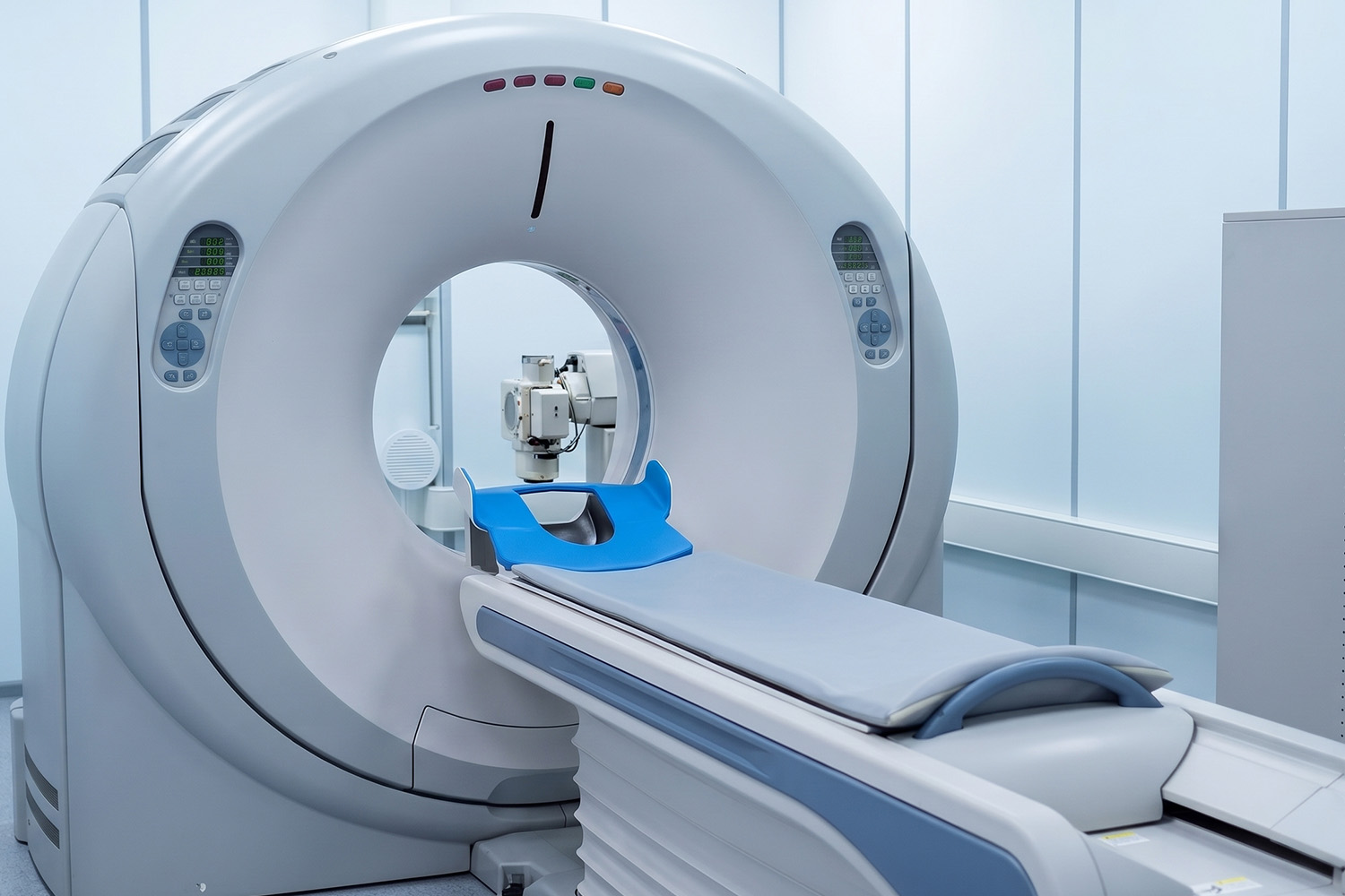 CT Scan (Computed Tomography)