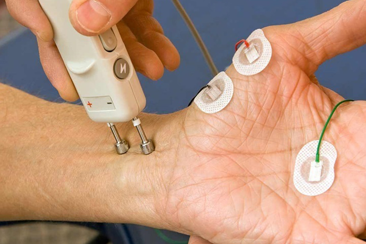 EMG (Electromyography)