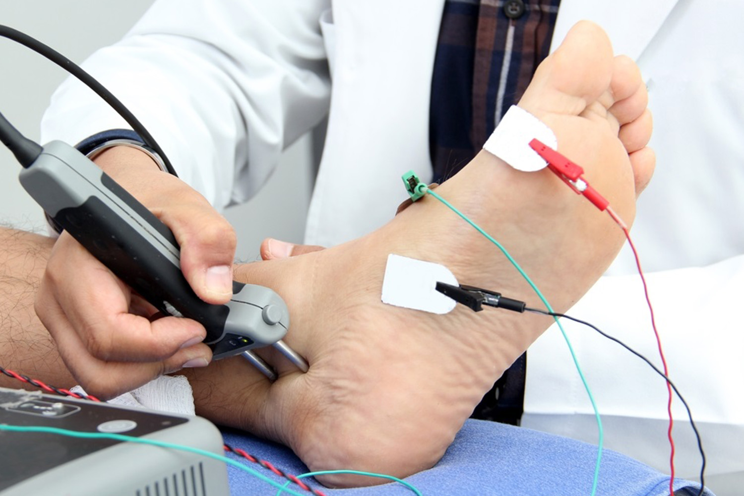 NCV (Nerve Conduction Velocity)
